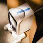 Pašalinama juosta laikinam tvirtinimui (fiksavimui) 